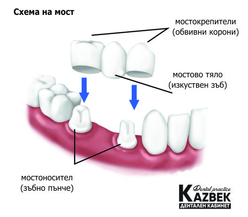 схема на мост